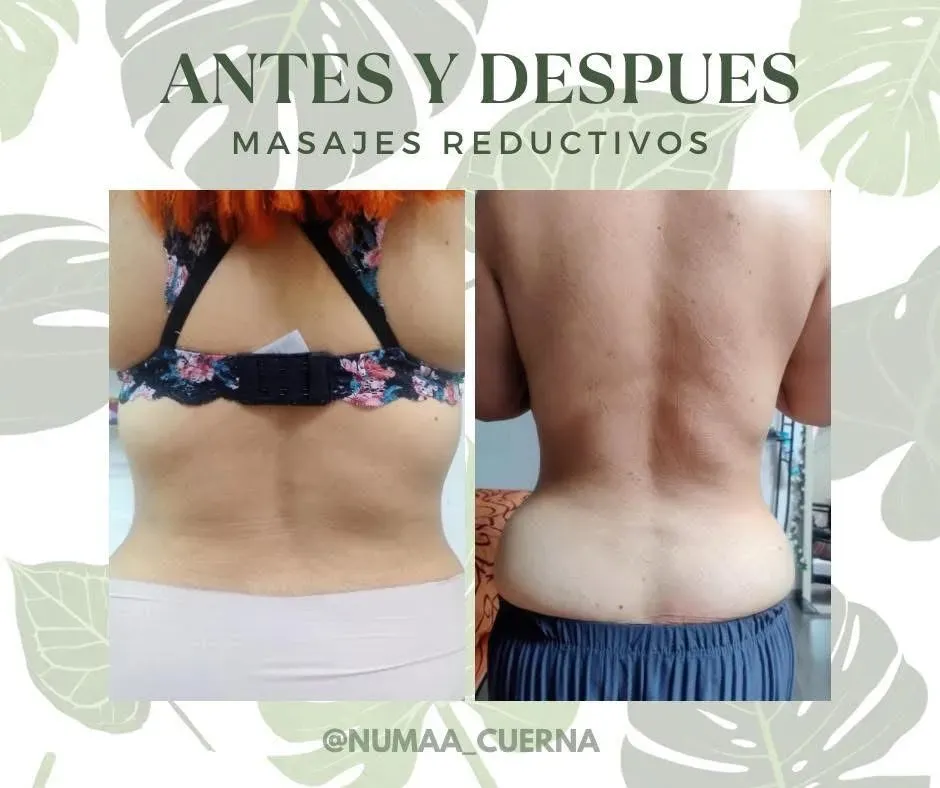 Antes - tratamiento reductivo