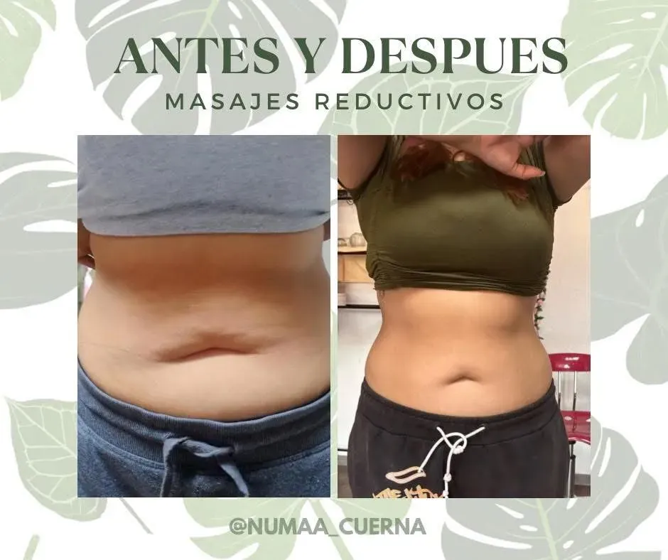 Después - tratamiento reductivo