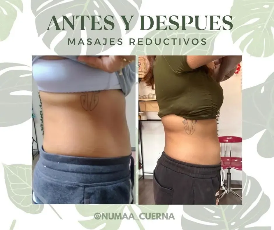 Antes - tratamiento reductivo