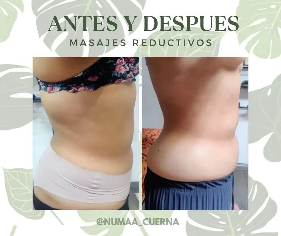 Después - tratamiento reductivo